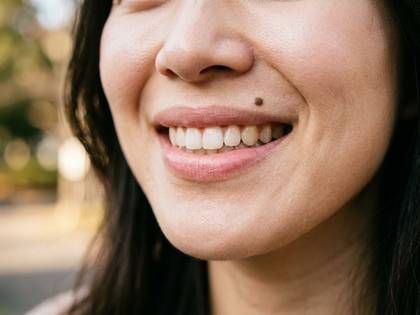 笑顔の女性の口元アップ。歯とほくろが見える。